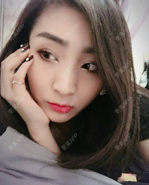 更美 - 我最靠谱儿的手臂脱毛经验 | 上海 | 手臂脱毛