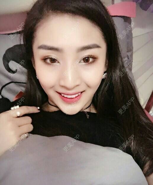 更美 - 我最靠谱儿的手臂脱毛经验 | 上海 | 手臂脱毛