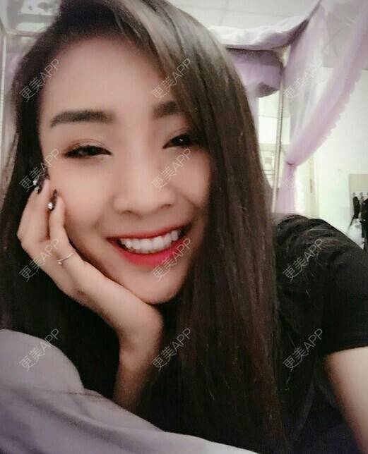 更美 - 我最靠谱儿的手臂脱毛经验 | 上海 | 手臂脱毛