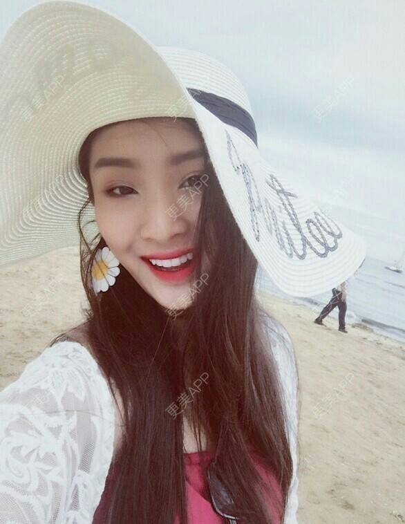 更美 - 我最靠谱儿的手臂脱毛经验 | 上海 | 手臂脱毛