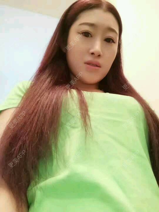 更美 - 偶尔回忆。的自体脂肪隆胸经验 | 自体脂肪隆胸 | 自体脂肪移植 | 隆胸日记 | 北京