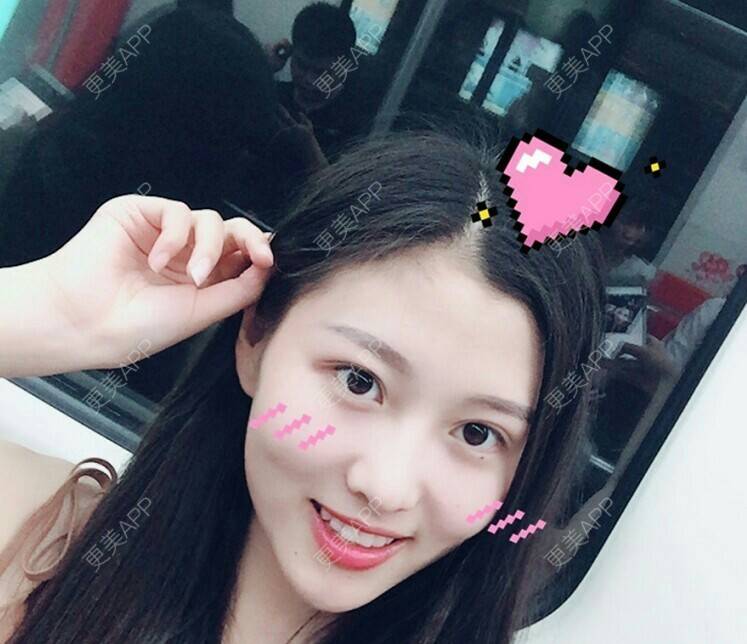 更美 - 小屁孩dEr的像素激光经验 | 上海 | 像素激光