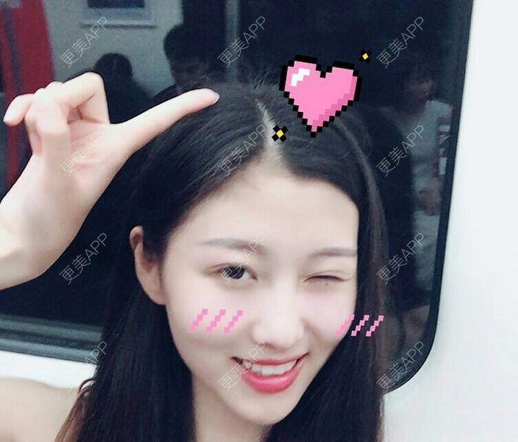 更美 - 小屁孩dEr的像素激光经验 | 上海 | 像素激光