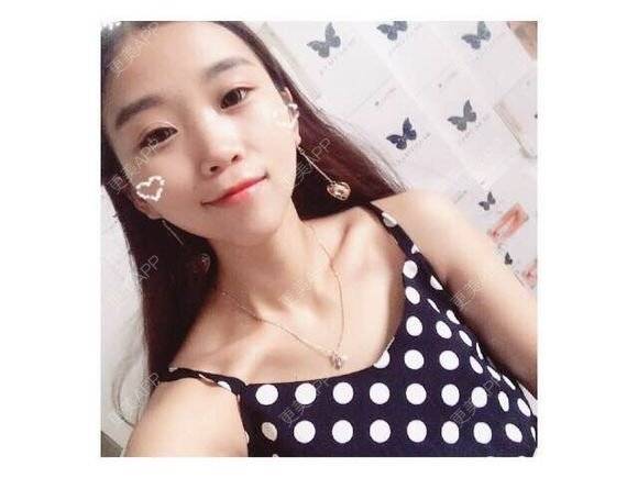 更美 - 黄金闪电的冷光美白经验 | 广州 | 冷光美白