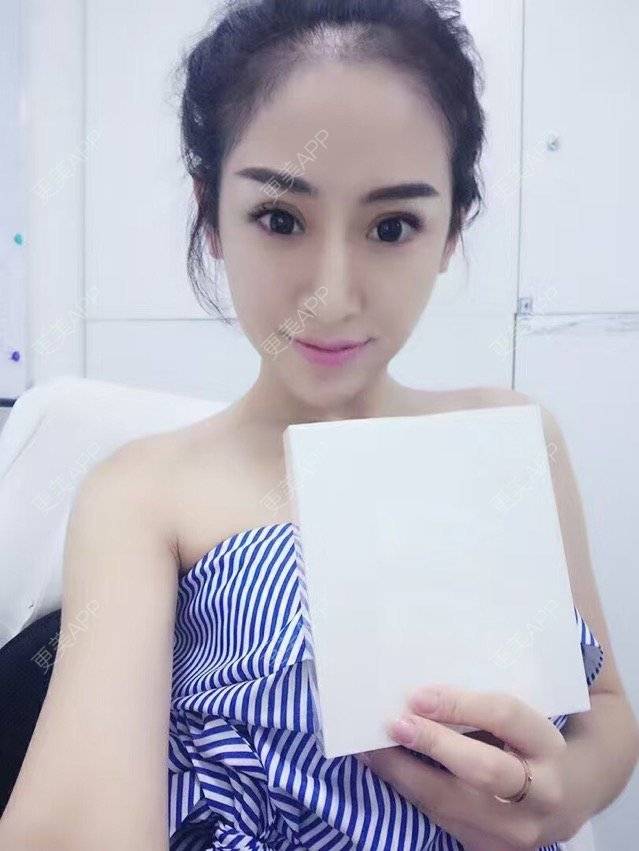 更美 - 青柠乖乖的除皱瘦脸经验 | 注射美容 | 视频日记 | 注射瘦脸针 | 除皱瘦脸 | 青岛
