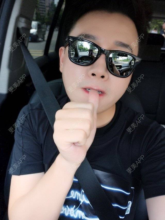 更美 - TAN导演的激光溶脂瘦脸经验 | 广州 | 激光溶脂瘦脸 | 怎样瘦脸