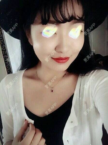 更美 - hfnjdgq的经验 | 天津 | OPT激光祛痘