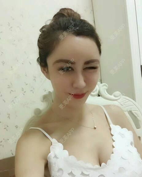 更美 - 网络主播欧美妹子的手臂脱毛经验 | 广州 | 脱毛 | 手臂脱毛 | 冰点激光脱毛