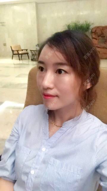 更美 - 饭碗的彼岸的埋线提升经验 | 埋线提升 | 面部轮廓 | 全面部提升 | 深圳