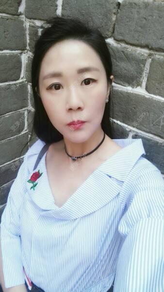 更美 - 柠檬茶来一杯的皮秒激光经验 | 北京 | 皮秒激光