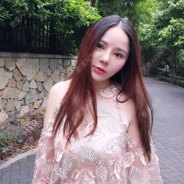 更美 - 祁梦🌂的鼻部多项经验 | 视频日记 | 重庆 | 缩鼻头鼻翼 | 达拉斯综合隆鼻 | 鼻部多项