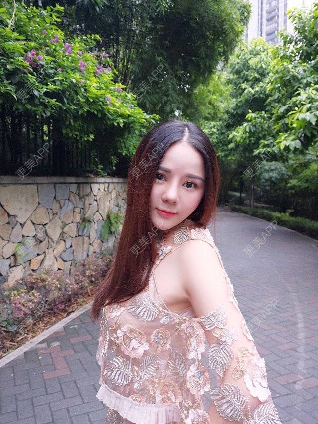 更美 - 祁梦🌂的鼻部多项经验 | 视频日记 | 重庆 | 缩鼻头鼻翼 | 达拉斯综合隆鼻 | 鼻部多项