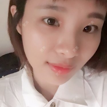 照相机、