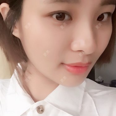 照相机、