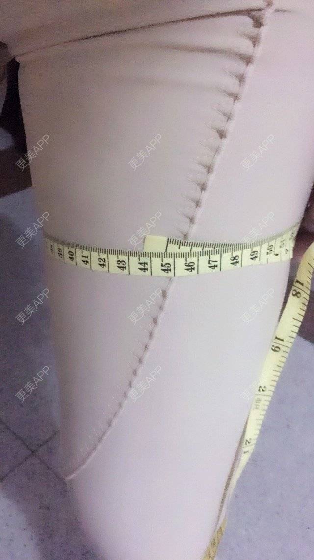 更美 - 照相机、的经验 | 注射美容 | 自体脂肪全面部填充 | 重庆 | 视频日记 | 吸脂手术