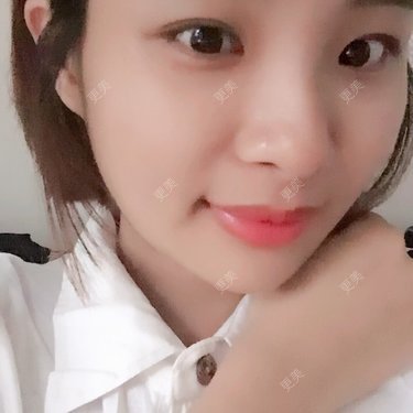 照相机、