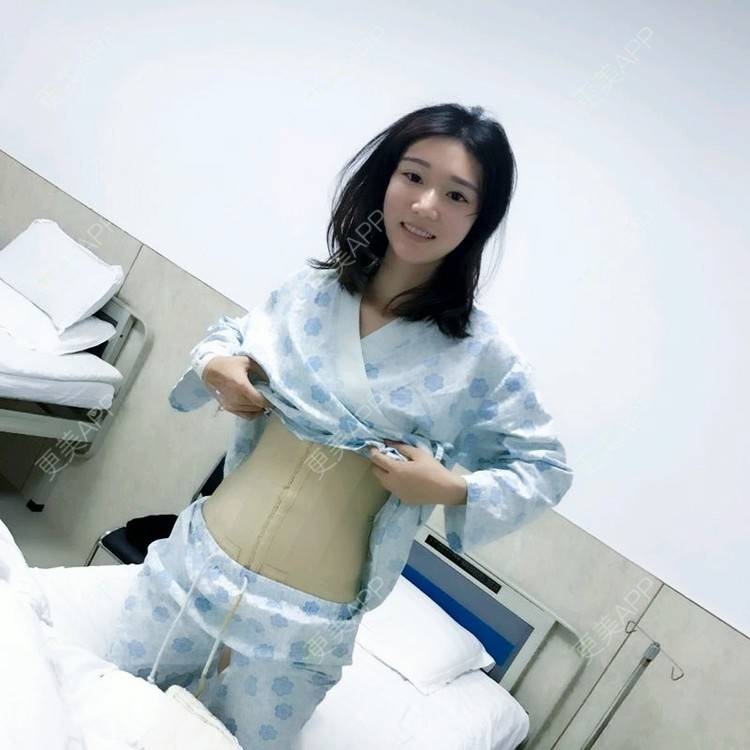 更美 - 霜霜无敌美女的腰腹吸脂经验 | 新乡 | 腰腹吸脂 | 吸脂瘦臀部