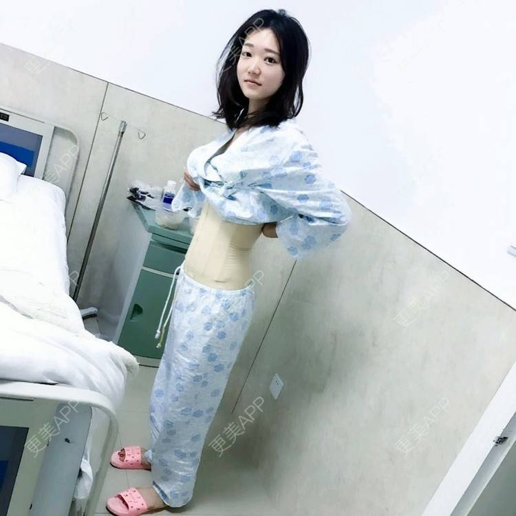 更美 - 霜霜无敌美女的腰腹吸脂经验 | 新乡 | 腰腹吸脂 | 吸脂瘦臀部