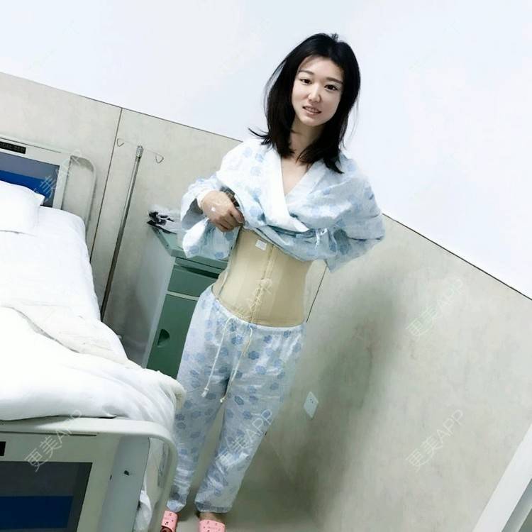 更美 - 霜霜无敌美女的腰腹吸脂经验 | 新乡 | 腰腹吸脂 | 吸脂瘦臀部
