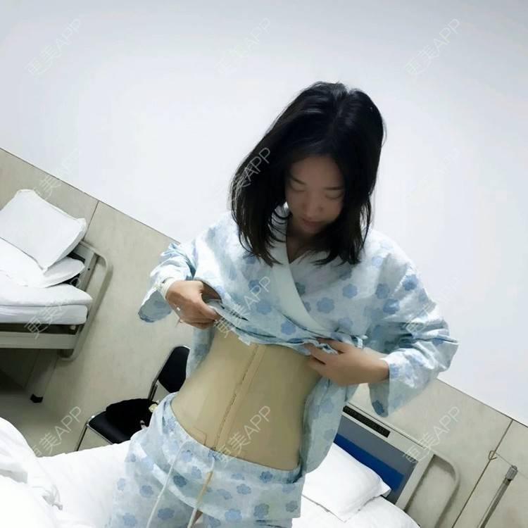更美 - 霜霜无敌美女的腰腹吸脂经验 | 新乡 | 腰腹吸脂 | 吸脂瘦臀部