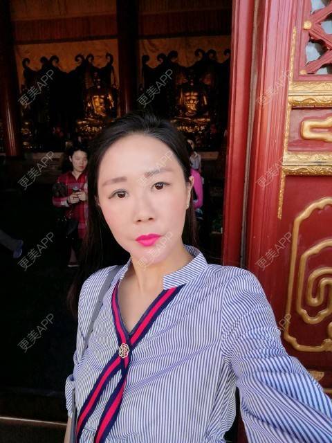 更美 - 柠檬茶来一杯的皮秒激光经验 | 北京 | 皮秒激光