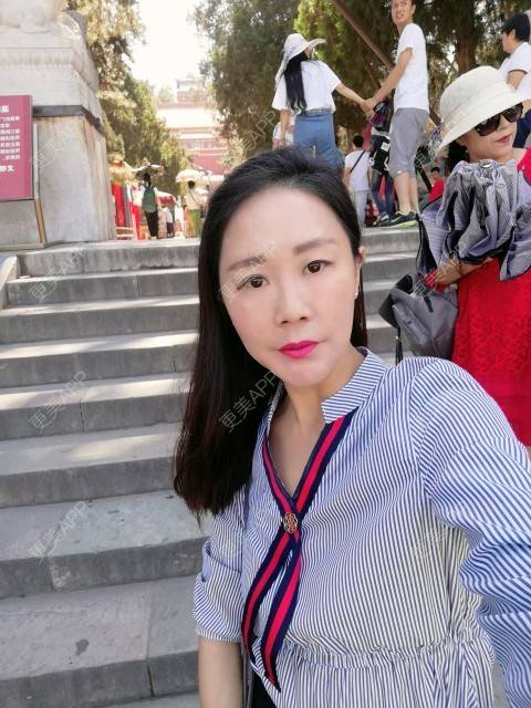 更美 - 柠檬茶来一杯的皮秒激光经验 | 北京 | 皮秒激光