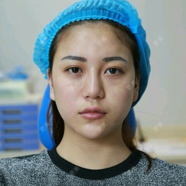 某美美