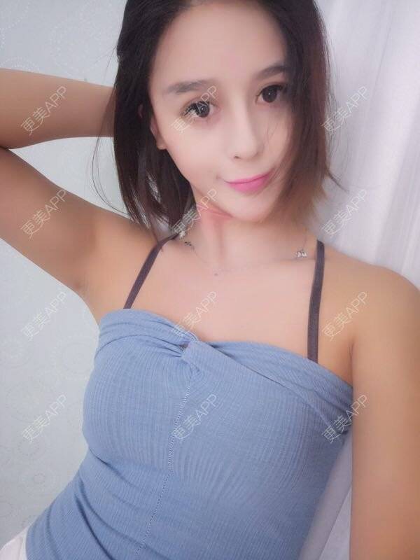 做女人挺好的自体脂肪隆胸日记