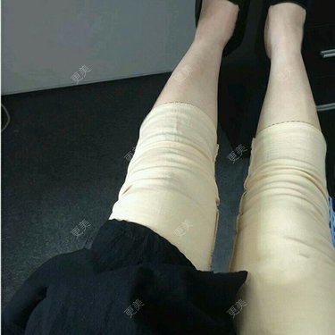 吕婧 医生