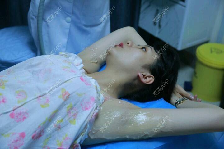 更美 - 更美用户vPu4xclMxP的激光脱腋毛经验 | 激光脱腋毛 | 口唇脱毛 | 超冰脱毛 | 南宁