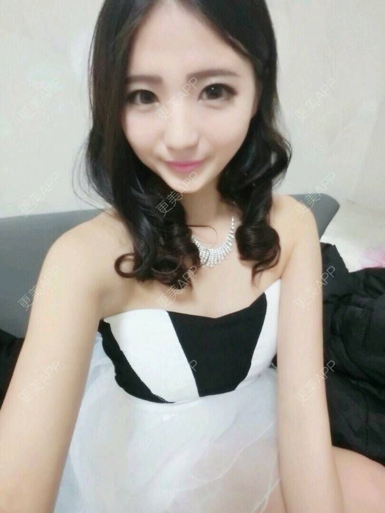 更美 - 爱嗨宝贝儿的吸脂瘦大腿经验 | 抽脂塑形 | 减肥抽脂 | 吸脂瘦大腿 | 北京