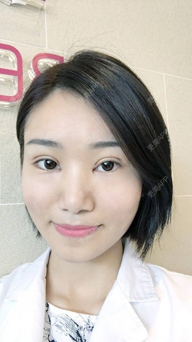 张珍的双眼皮日记