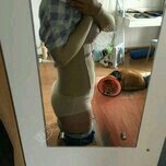 抽脂少妇