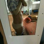 抽脂少妇