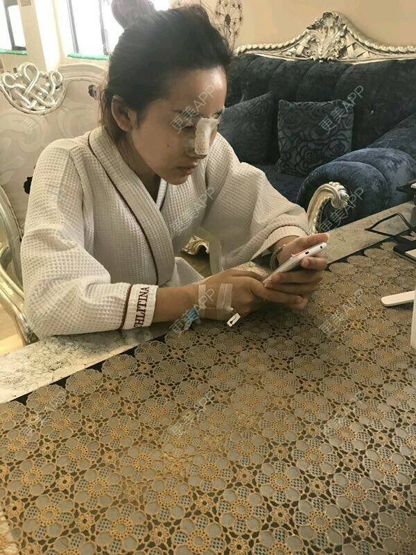更美 - 更美用户6Ldsb8odGC的鼻部综合经验 | 隆鼻失败修复 | 鼻部综合 | 鼻部多项 | 鼻修复 | 南宁