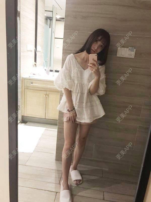 更美 - 米米宝宝2的吸脂瘦大腿经验 | 成都 | 视频日记 | 吸脂瘦大腿