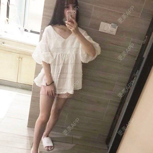 更美 - 米米宝宝2的吸脂瘦大腿经验 | 成都 | 视频日记 | 吸脂瘦大腿