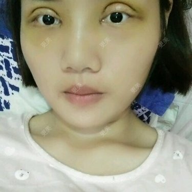 口口做好