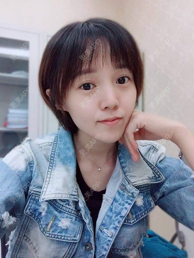更美 - 平小瓶er的双眼皮经验 | 视频日记 | 美丽日记 | 同仁医院马涛 | 公立医生 | 全切双眼皮专家 | 双眼皮 | 精雕全切双眼皮 | 精华自荐 | 名流双眼皮 | 专家 | 微创三点双眼皮开眼角 | 北京