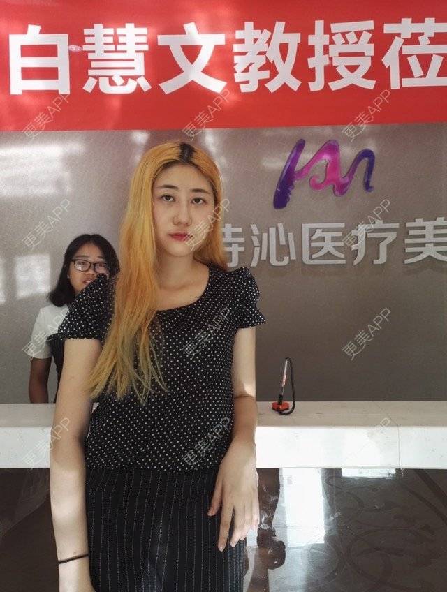 更美 - 北京美诗沁医疗美容的祛眼袋经验 | 北京 | 祛眼袋