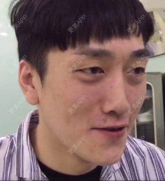 更美 - 北京美诗沁医疗美容的祛眼袋经验 | 北京 | 祛眼袋