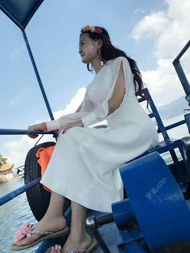 更美 - 秦菲的隆鼻经验 | 硅胶假体隆鼻 | 昆明 | 隆鼻 | 鼻部多项