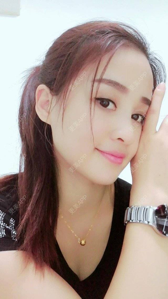 更美 - 狐狸-FOX的经验 | 重庆 | 自体脂肪填充面颊 | 自体脂肪填充额头