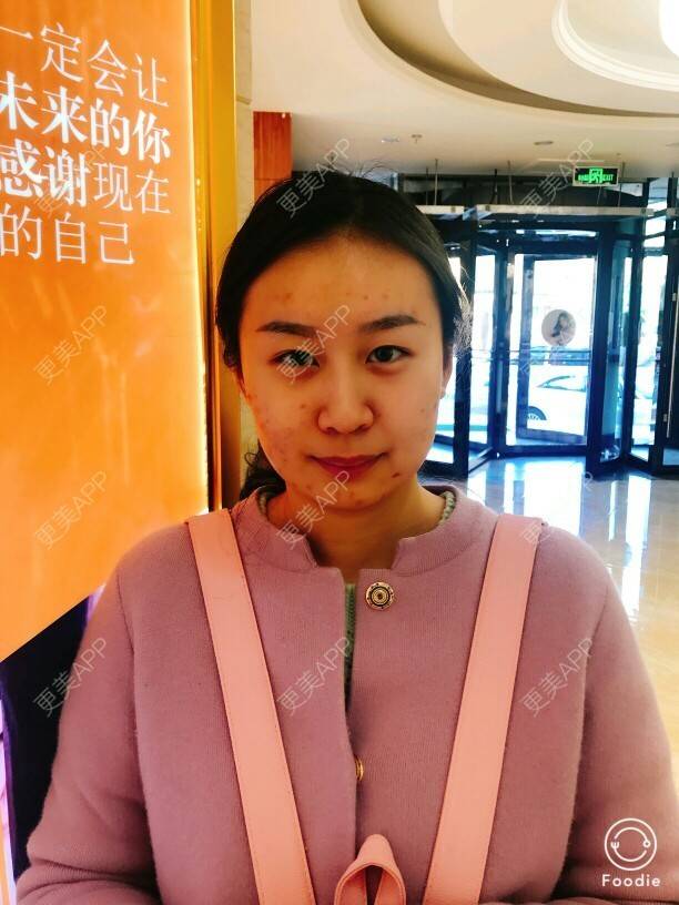 更美 - ⭐涵涵爱星星⭐的除皱瘦脸经验 | 注射瘦脸· | 哈尔滨 | 除皱瘦脸 | 怎样瘦脸