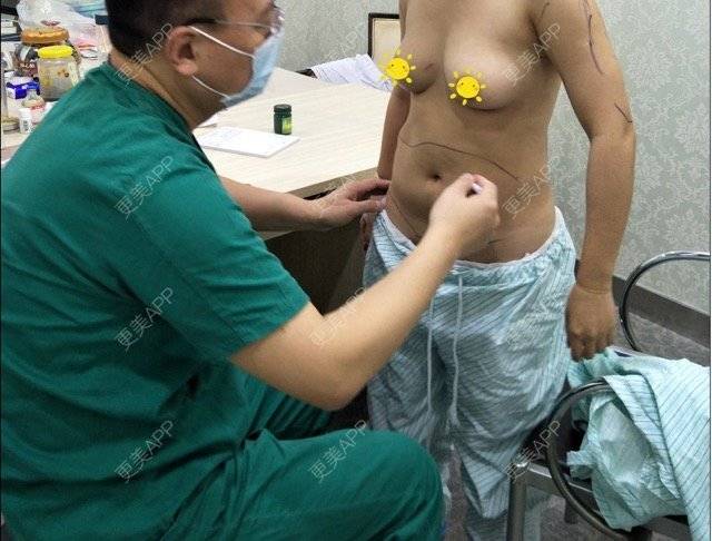 更美 - 宛若霓裳的腰腹吸脂经验 | 侧腰吸脂 | 腰腹吸脂 | 树洞：八卦和我讲！ | 深圳