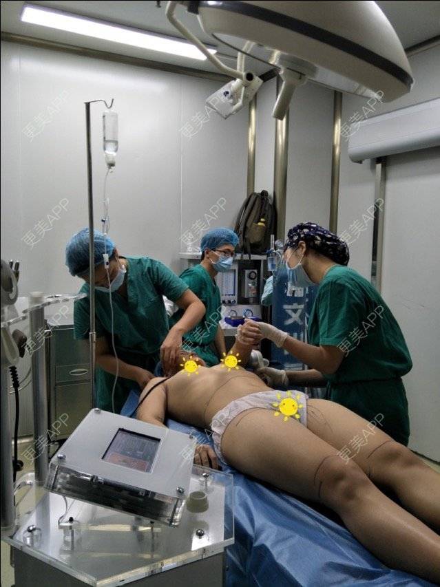 更美 - 宛若霓裳的腰腹吸脂经验 | 侧腰吸脂 | 腰腹吸脂 | 树洞：八卦和我讲！ | 深圳