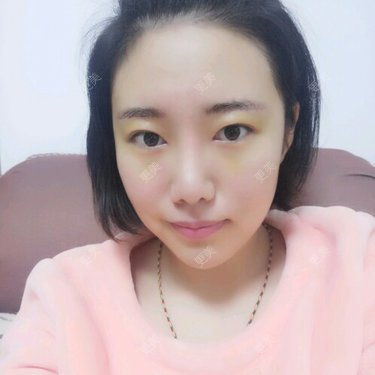 Cold婷
