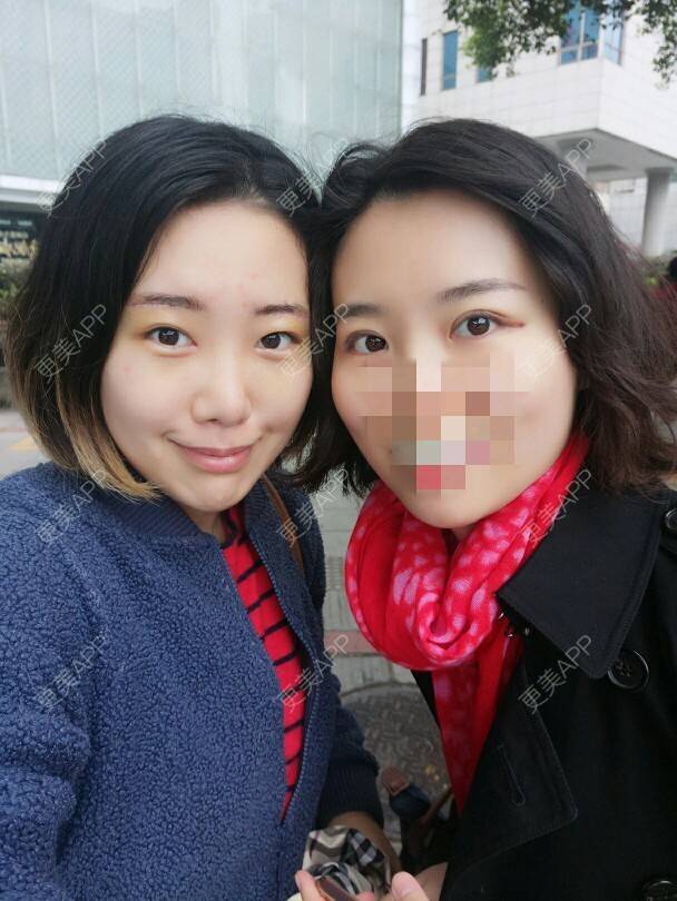更美 - Cold婷的切眉经验 | 眼眉整形 | 切内眼角 | 切眉 | 长沙