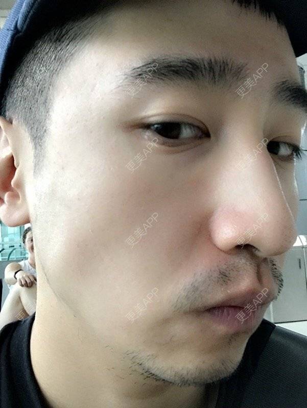 更美 - 陈八哥的经验 | 树洞：八卦和我讲！ | 上海