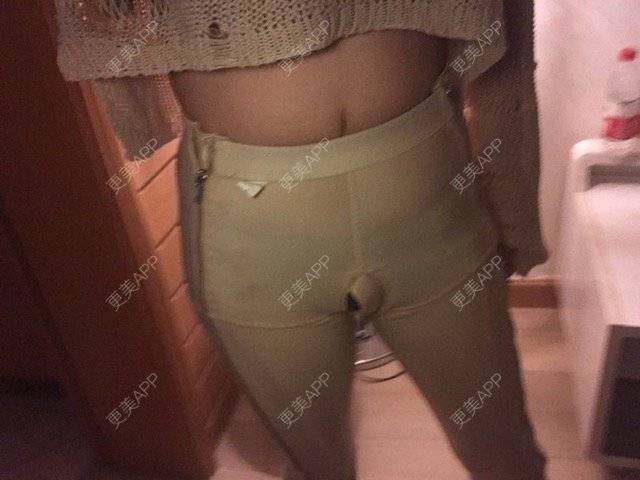 更美 - 朱渺 医生的吸脂瘦大腿经验 | 长沙 | 吸脂瘦大腿